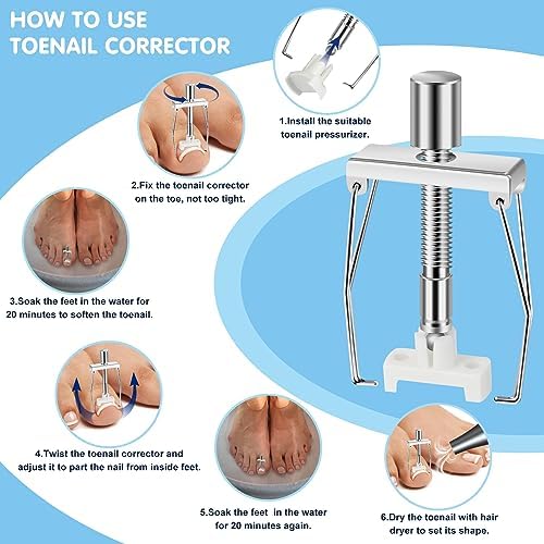 Ingrown Toenail Removal Kit Includes Ingrown Toenail Corrector, Tweezer, 50pcs Nail Patches,12 Nail Retainer,10 Toenail Corrector Strips