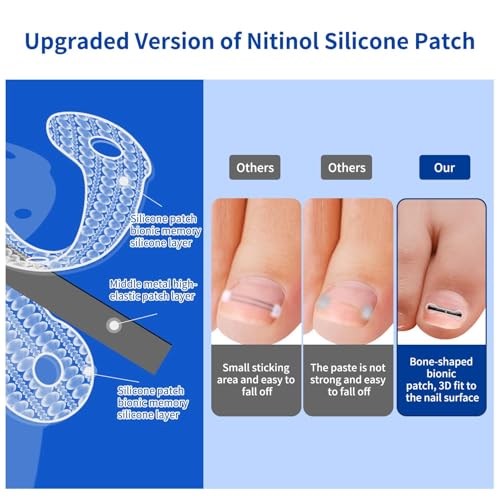 Ingrown Toenail Treatment, 10 packs Titanium Alloy Ingrown Toenail Corrector for all size foot, Ingrown Toenail Removal Kit for Curved Nail Repair, at Home Nail Kit Tools-Blue2