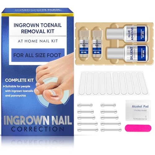 Ingrown Toenail Treatment, 10 packs Titanium Alloy Ingrown Toenail Corrector for All Size Curve Correct Ingrown Toenail, Ingrown Toenail Removal Kit for Straightener of Big Toe