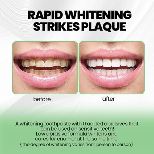 2PCS Hydroxyapatite Toothpastes 10%,Fluoride-Free Toothpaste, Gentle Mint, Fresh Breath, Daily Use for Oral Health 4.23oz (2pcs)