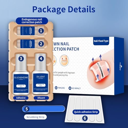 Ingrown Toenail Treatment, 10 packs Titanium Alloy Ingrown Toenail Corrector for all size foot, Ingrown Toenail Removal Kit for Curved Nail Repair, at Home Nail Kit Tools-Blue2