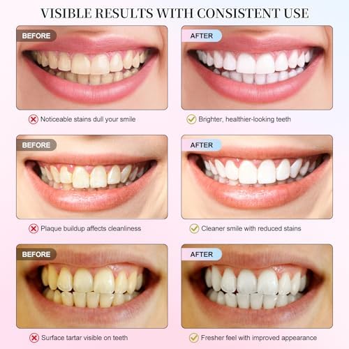 2Pack Niacinamide Whitening Toothpaste,Gum Repair, Effectively Whitens Teeth, Protects Tooth Enamel, Effectively Whitens Teeth, Protects Tooth Enamel,Freshens Breath 24 Hours