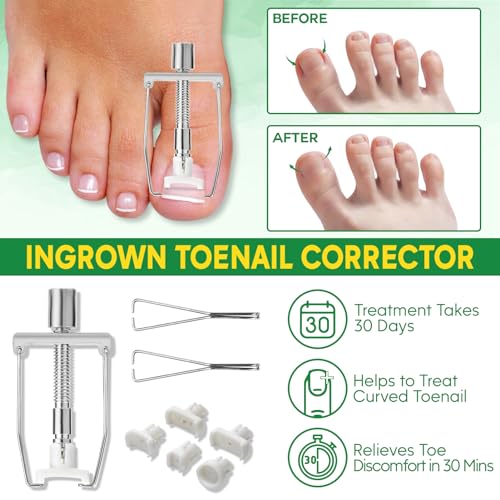 Ingrown Toenail Tools Kit, Ingrown Toenail Treatment, Stainless Steel Ingrown Toenail Removal Kit, Ingrown Toenail Corrector, Corrector Patch, Toenail Clipper, Nail File Lifter Pedicure Tool