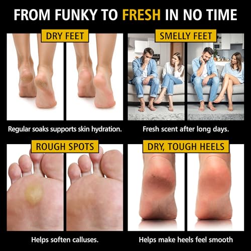 Heavy Duty Tea Tree Oil Foot Soak - Epsom Salt for Soaking for Odor & Footbath to Soften Calluses - Athletes Foot - Nail Discoloration - Relaxing Pedicure Soak - Dry Skin & Rough Heels - 16oz