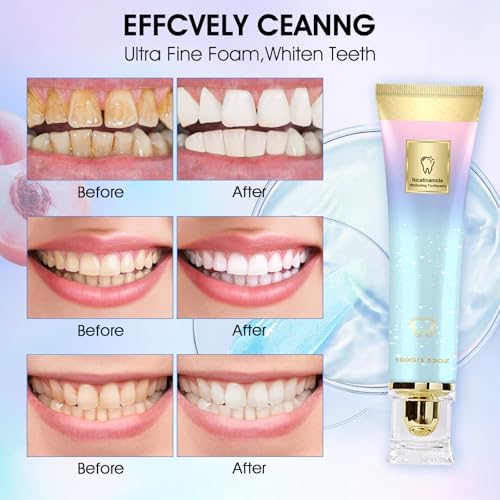 2PCS Niacinamide Whitening Toothpaste, Niacinamide Toothpaste, Whitening Teeth, Fresh Breath, Remove Tooth Stains