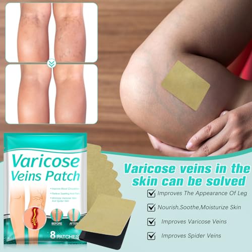 2pc Varicose Veins Treatment for Legs – Professional Varicose Veins Cream & Patch, Naturally Improves Leg Appearance