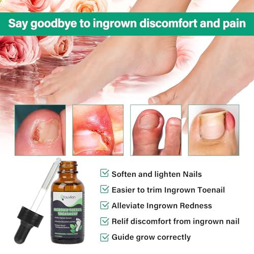 Ingrown Toenail Treatment - Ingrown Toenail Softener Drops,Toenail Lifter,Nail Patches,Best Ingrown Toenail Kit at Home for Easy Trim Thick Toe Nails Cleaner Tool Kit