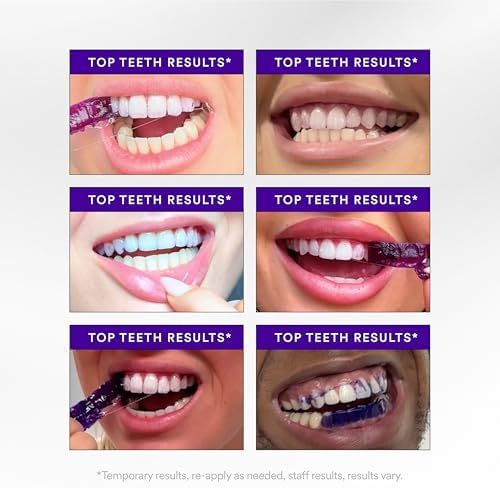 Hismile V34 Whitening Strips, Teeth Whitening Strips, Purple Tooth Whitening, Tooth Stain Treatment, Combining Whitening and Colour Correction