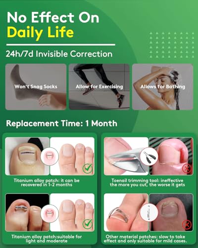 Ingrown Toenail Treatment Kit - Titanium Alloy Nail Corrector Tools, Quick Relief & Long-term Correction Patch for Ingrown Nails, Solution for Curved Toenail Repair & Removal (0.51/0.59/0.67/0.79in)