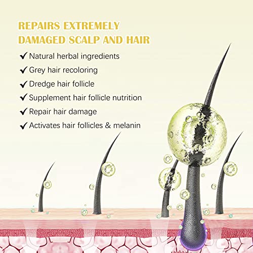 2Pack 5% Minoxidil for Men and Women Hair Growth Serum, Biotin Infused Hair Regrowth Treatment for Beard & Scalp Hair Loss & Thinning, Promotes Thicker, Fuller, Healthier Hair - 4.04 oz