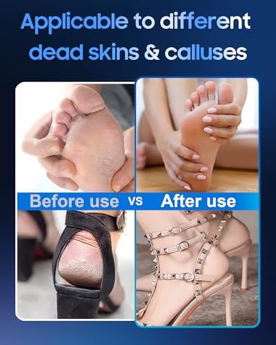 11000 RPM Rechargeable Electric Foot Callus Remover with 2Glass Sander Discs - Cordless Foot Scrubber,Professional Pedicure Tool for Dead Skin and Calluses,Electric Foot File - Blue