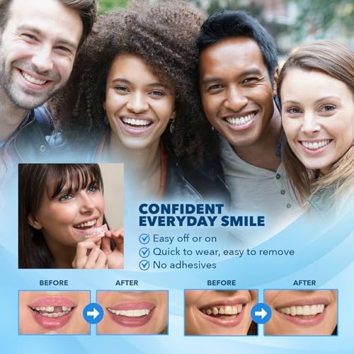 Imako Premium Cosmetic Uppers - 1 Pack - Small, Bleached White - DIY Smile Makeover - Made in USA