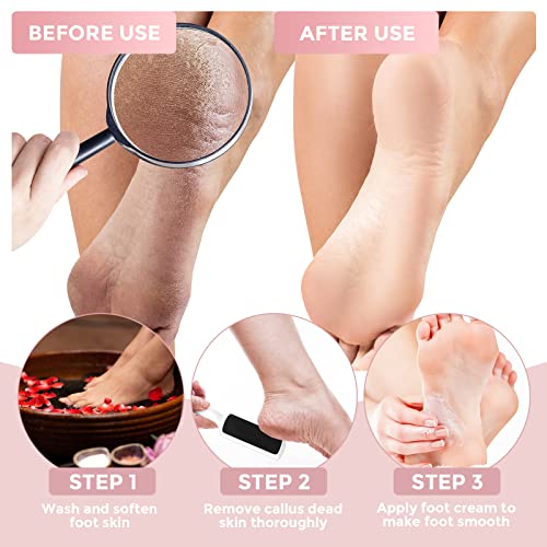 30 Pcs Foot File Dead Skin Foot Scrubber Remover Pedicure Double Sided Callus Heel Foot Scraper Professional Foot Exfoliator Feet Rasp for Smoothing Hard Rough Skin Kit, Pink, White, 7.87 x 1.77 Inch