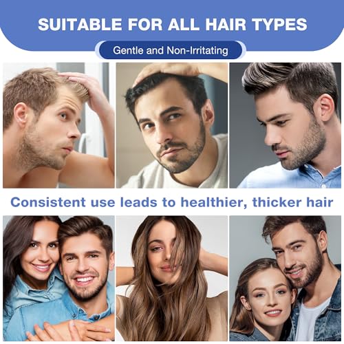 5% Minoxidil for Men Hair Growth Serum - Minoxidil for Women Serum with Biotin for Thicker & Healthier, Topical Minoxidil for Men Restore Fuller Beard