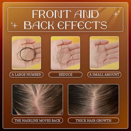 300ML Anti-Hair Fall Hair Loss Shampoo - Shampoo for Women Hair Loss, Rich in Various Plant Extracts, Anti-Hair Fall Promote Hair Growth (2)