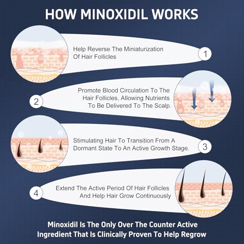 4 Packs Minoxidil Foam, 5% Minoxidil for Men and Women, Infused with Biotin, Hair Growth Treatment, Supports Thicker and Fuller Hair & Beard, Upgraded version (Minoxidil Foam 8.44Oz, 4-Month Supply)