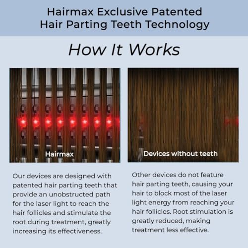 Hairmax Ultima 12 Classic LaserComb- (FDA Cleared) Laser Hair Regrowth Treatment Device for Men & Women - Reverses Thinning Hair Loss - Red Light Therapy to Stimulate Hair Growth - Cordless Design
