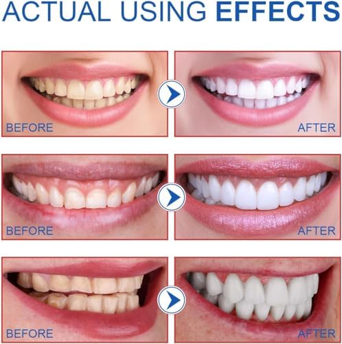 2PCS-SP-6 Whitening Toothpaste, Teeth Whitening, Enamel-Safe, Fluoride-Free, Fresh Mint, Fresh Breath