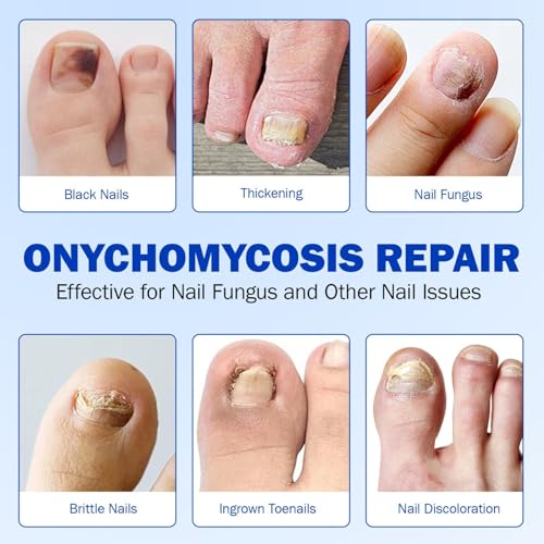 42pcs Toenail Fungus Treatment Extra Strength,Nail Patches for Nail Treatment Overnight,Nail Repair for Damaged Nails Care