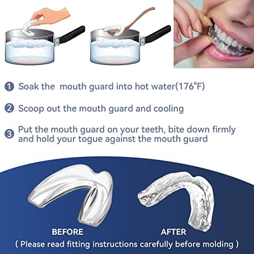 4 Pack Kids Mouth Guards for Teeth Grinding, Small Size, Comfortable Night Guard for Kids, Professional Mouth Guards, Effective for Clenching Teeth