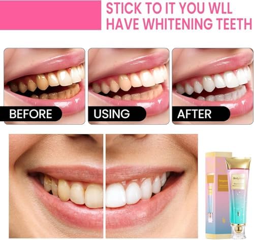 3 Pack Niacinamide Whitening Toothpaste, BodyAccel Triple Whitening Niacinamide Toothpaste, Brightens and Whitens Teeth, Stain Removal Natural Gentle, Fresh Breath