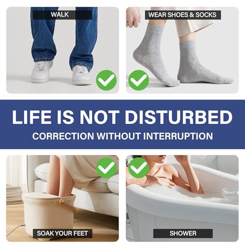 Ingrown Toenail Treatment, 10 packs Titanium Alloy Ingrown Toenail Corrector for All Size Curve Correct Ingrown Toenail, Ingrown Toenail Removal Kit for Straightener of Big Toe