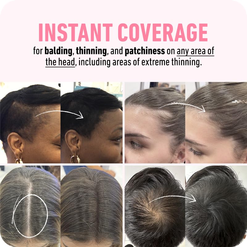 BOLDIFY Hairline Powder (LARGE, 10g) - Root Touch Up Hair Color for Gray Coverage - Bald Spot Concealing Hair Powder for Women & Men - 48-Hour Stain-Proof - Ash Brown