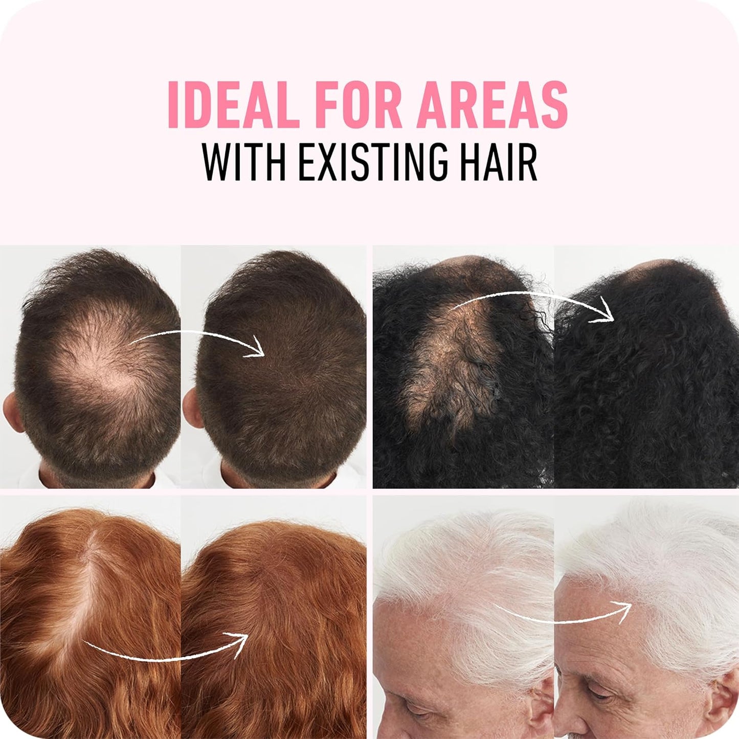 BOLDIFY Hair Fibers 12g | Thinning Hair Solution | Hazel Brown | For Men & Women